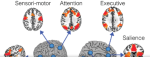 Functional Connectivity Mapping in Preoperative Neurosurgical Planning