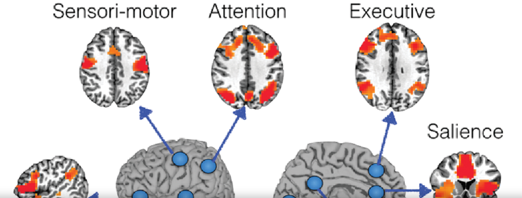 Functional Connectivity Mapping in Preoperative Neurosurgical Planning