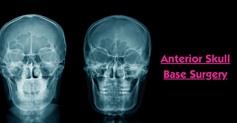 The Role of MRI in Skull Base Surgery