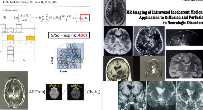 Diffusion MRI in Neurosurgical Practice