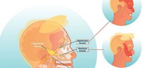 The Role of MRI in Cranial Nerve Disorders and Neurosurgical Treatment