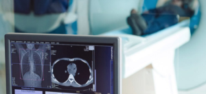 Advances in MRI Technology: What’s Next for Medical Imaging?