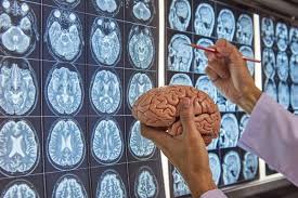 Neurosurgery